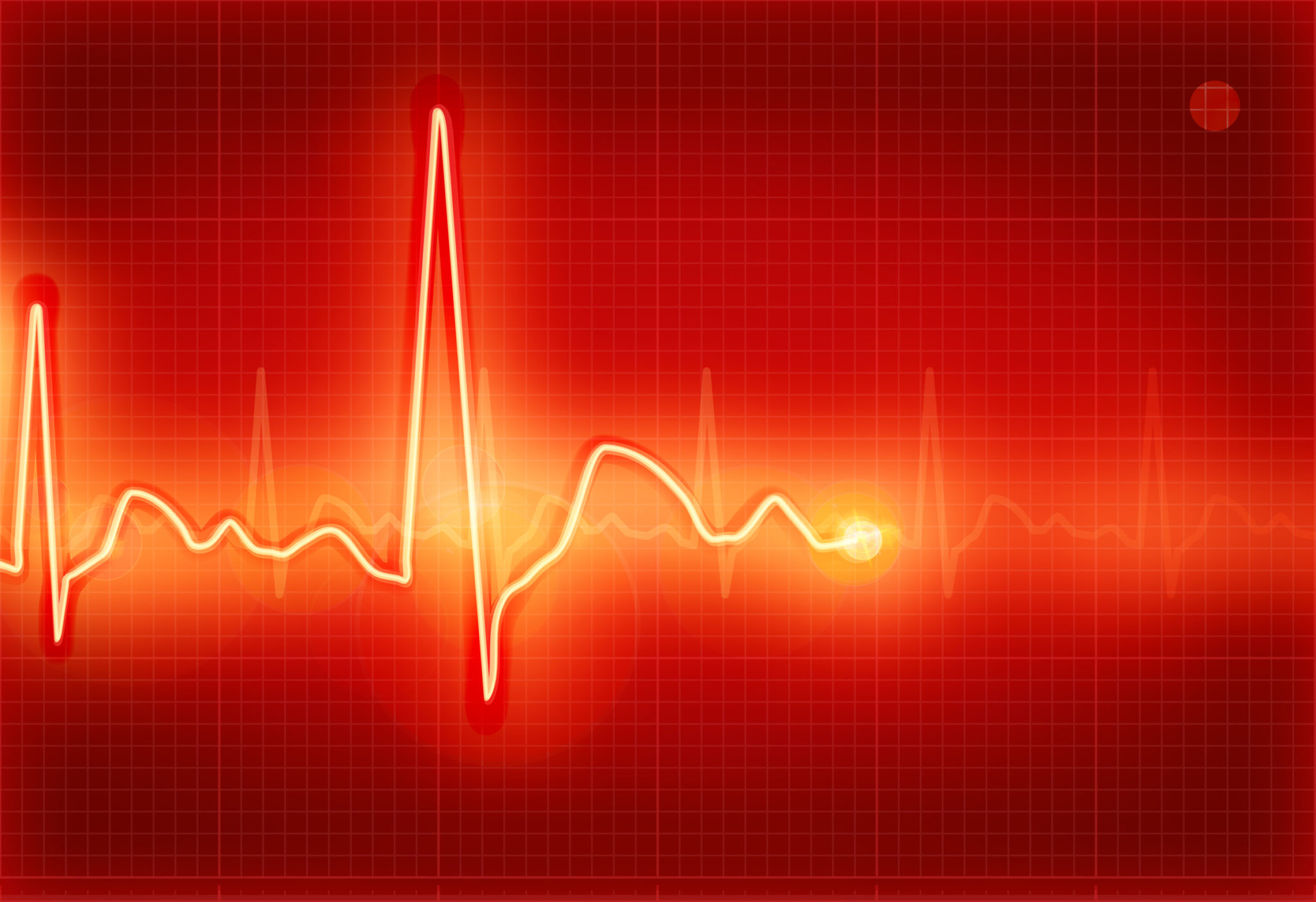 What is the RDI (Remote Defect Indicator)? - Sierra Hardware Design's Blog